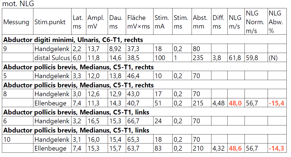 Tabelle der motorischen Neurographie-Werte für den Nervus medianus und Nervus ulnaris beidseits, inklusive Latenzen, Amplituden und Nervenleitgeschwindigkeiten.